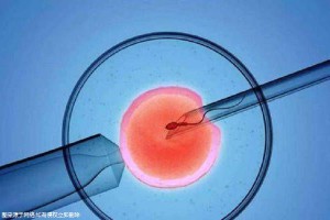 关于供卵代生公司